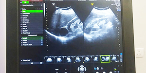 Ultrasonography