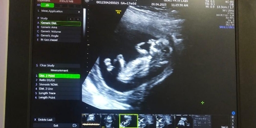 Advance-Automated-Equipment-4